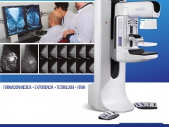 Mamografía Digital y Tomosíntesis